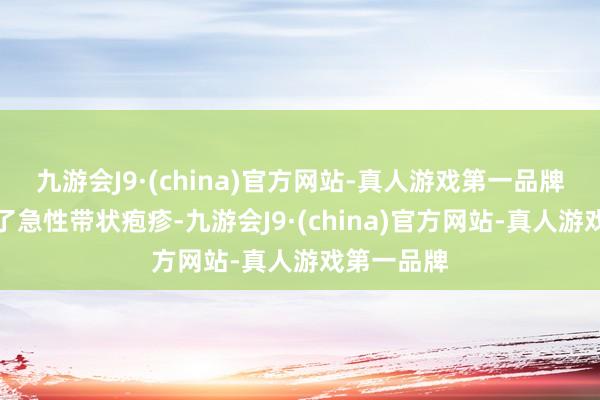 九游会J9·(china)官方网站-真人游戏第一品牌我方患上了急性带状疱疹-九游会J9·(china)官方网站-真人游戏第一品牌